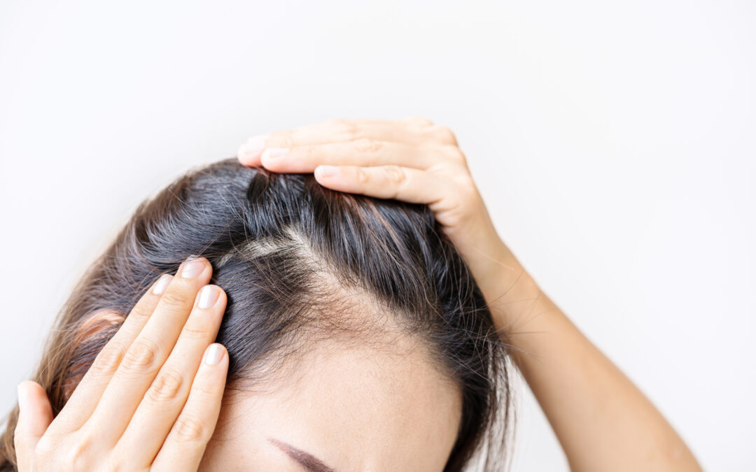 Common Myths about Hair Loss