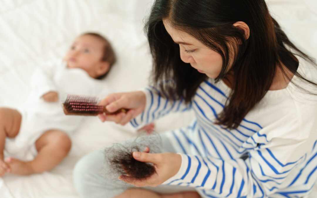 Opciones de tratamiento para la caída del cabello posparto