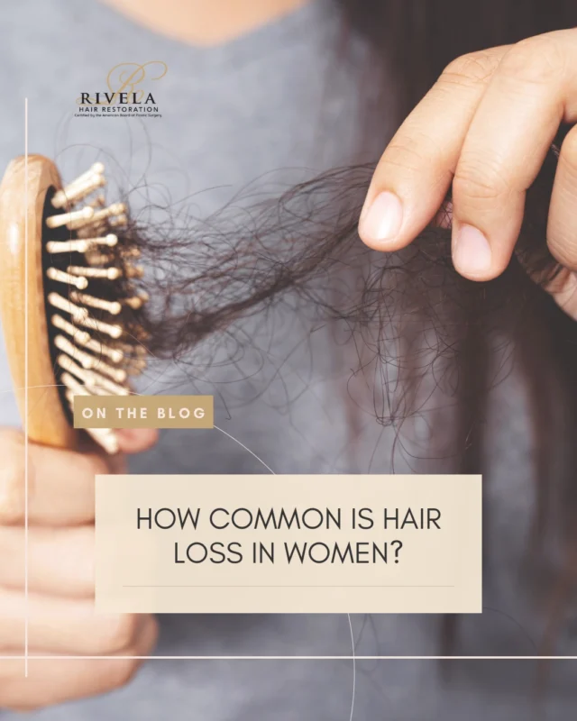 Hair loss isn’t just a men’s issue; nearly half of all women will experience it in their lifetime. 

At Rivela Hair Restoration, we understand the emotional toll it can take and offer innovative, minimally invasive treatments to help women regain their confidence and feel like themselves again. From NeoGraft transplants to PRP therapy and Keravive scalp treatments, we tailor solutions to your unique needs — all led by the expertise of Dr. Lucian Rivela.

Learn about the causes, treatments, and support available for female hair loss on our blog.

#RivelaPlasticSurgery #TheWoodlands #TheWoodlandsPlasticSurgery #PlasticSurgeryHouston #BoardCertifiedPlasticSurgeon #TheWoodlandsTX #RivelaHairRestoration #HairRestoration #Blog #WeightLoss #HairLoss